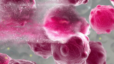 CSUN biology professor Cristian Ruiz is developing a new method for detecting cancer in its early stages. The above illustration is a damaged cancer cell. Illustration by vitanovski, iStock.