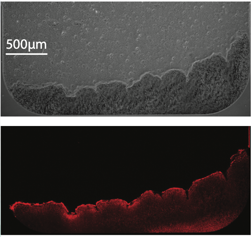 "Microscopic images of a biofilm under attack by antimicrobial peptides reveal that not all cells are affected. A fluorescent image of specific biological markers (bottom image) shows that some cells survive the therapy.”